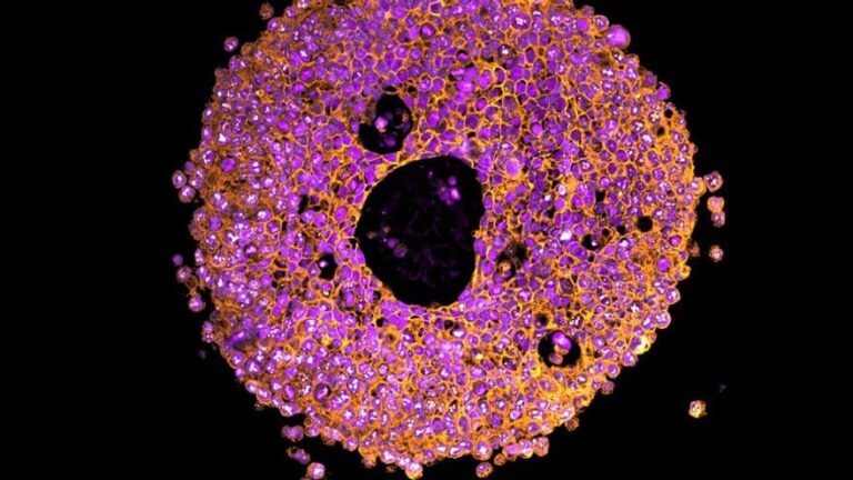 Desarrollan las primeras miniplacentas artificiales impresas en 3D