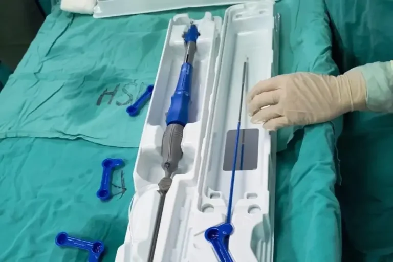 Intervención cardíaca mínimamente invasiva en el Hospital San Roque de Córdoba